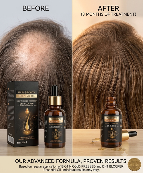 Hair Growth Oil